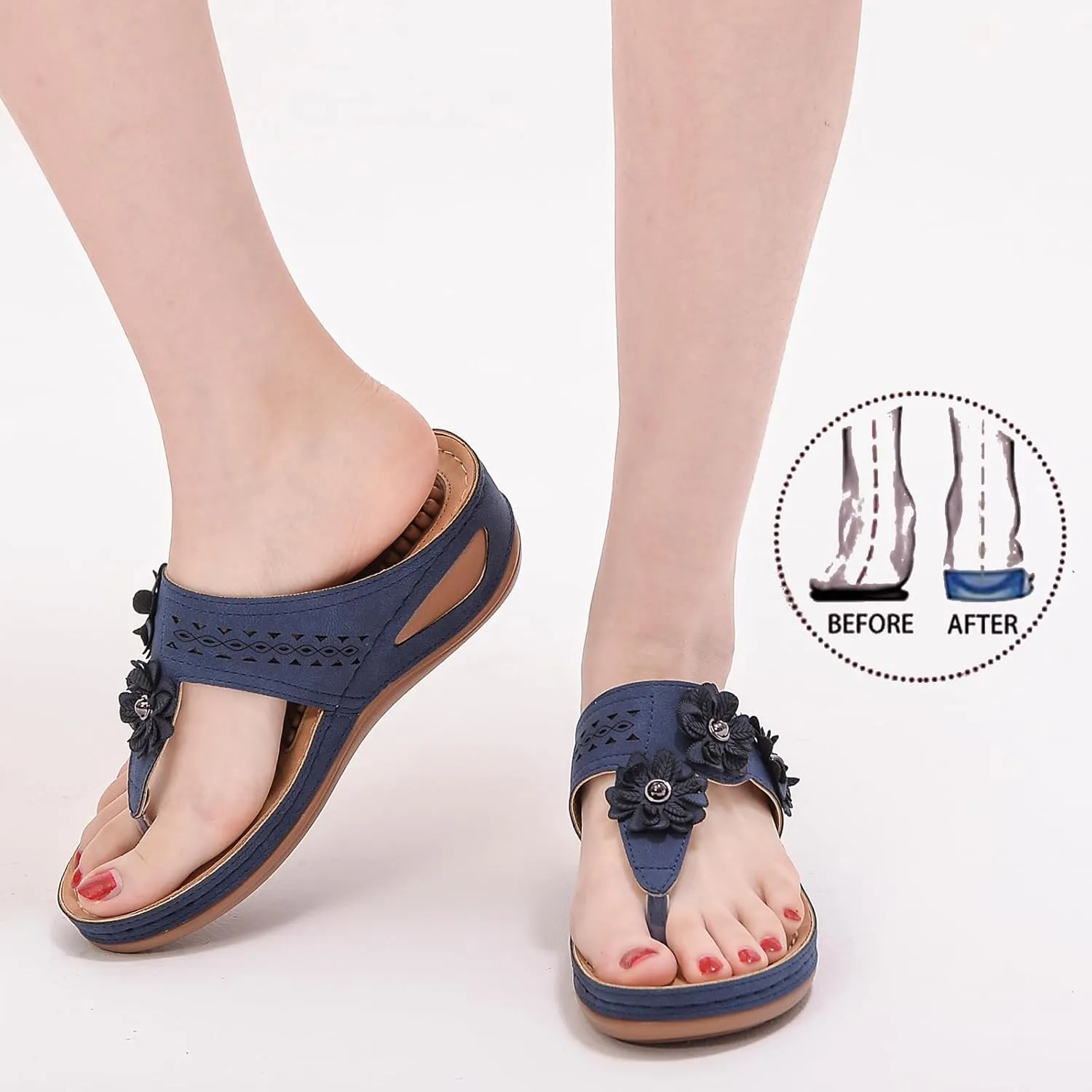 Sandals for Women Wedge Shoes Comfortable Orthopedic Sandals, Womens Dressy Summer Flip Flops Platform Footwear Casual Walking Wedges Flower Orthopedic Flip Flops